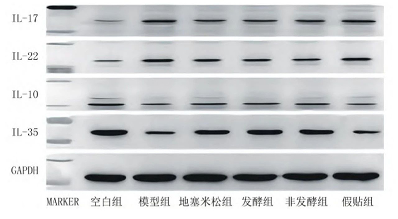 空白組和支氣管哮喘各組大鼠肺組織中IL－17、IL－22、IL－10、IL－35蛋白表達(dá)電泳圖
